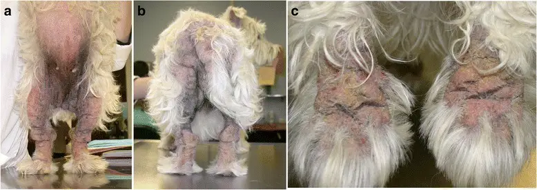 Atopic Dermatitis